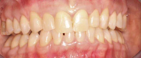 How TMJ Treatment Changed A Life