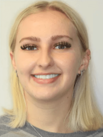 Finding TMJ Relief with Neuromuscular Dentistry