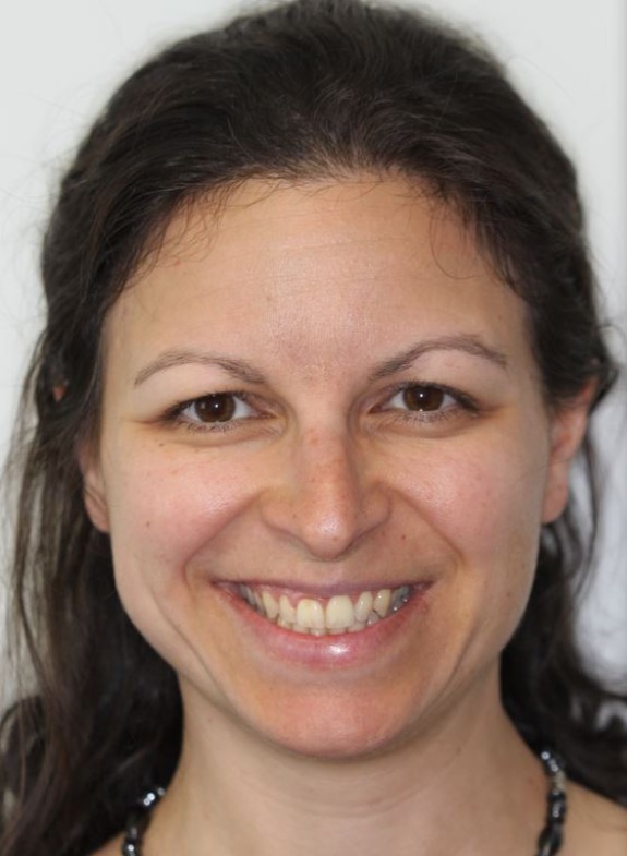 Transformative TMJ Treatment