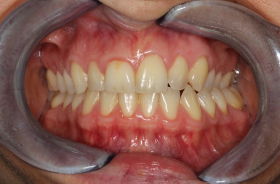 Transformative TMJ Treatment